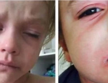 Η μητέρα έβλεπε το παιδί της να σφαδάζει από τον πόνο και τότε αποφάσισε... (βίντεο-φωτο)